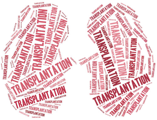MIT Sloan Professors Develop Data-Based Model for Transplant Decisions