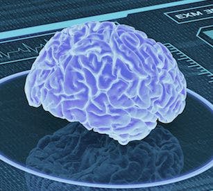 DARPA Funds AI-Based Brain Implants to Treat Depression