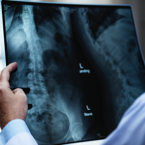 FDA Clears Real-Time Imaging Tech for Spine Surgery