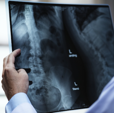 Will AI Replace the Radiologist?