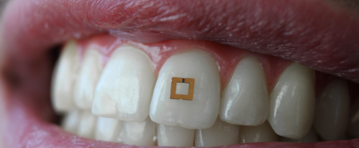 tooth sensor,tufts tooth,omenetto,hca news