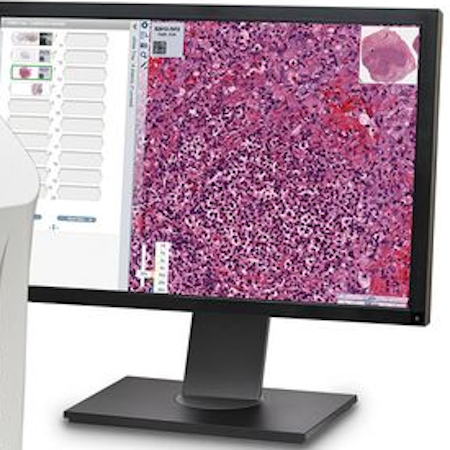 Mount Sinai & LabCorp to Launch Digital Pathology Center