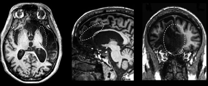 brain scan, imaging, software