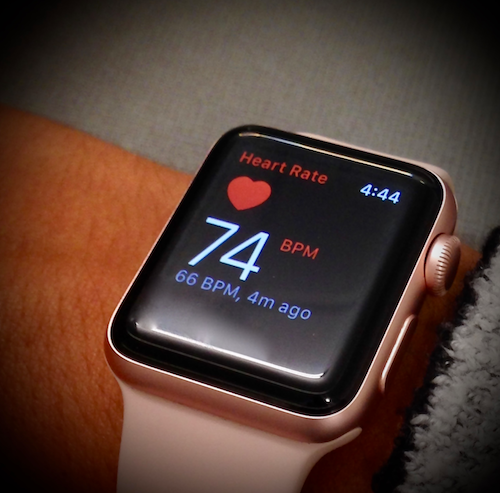 No, Apple Watch Can't Detect Irregular Heart Rhythms with 97% Accuracy (Yet)