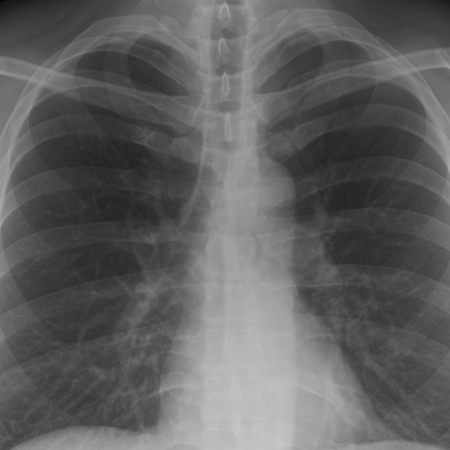 Enlitic Secures $15M for Chest X-Ray Interpretation AI Solution