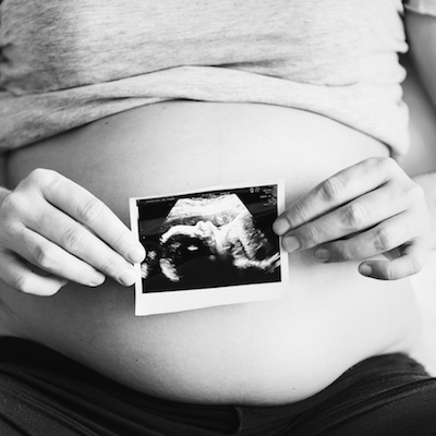 Podcast: Using Analytics, Precision Medicine to Improve Preterm Infant Outcomes